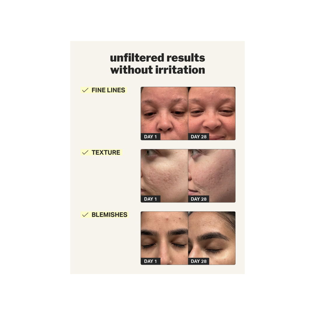 Retinol Gel Cream