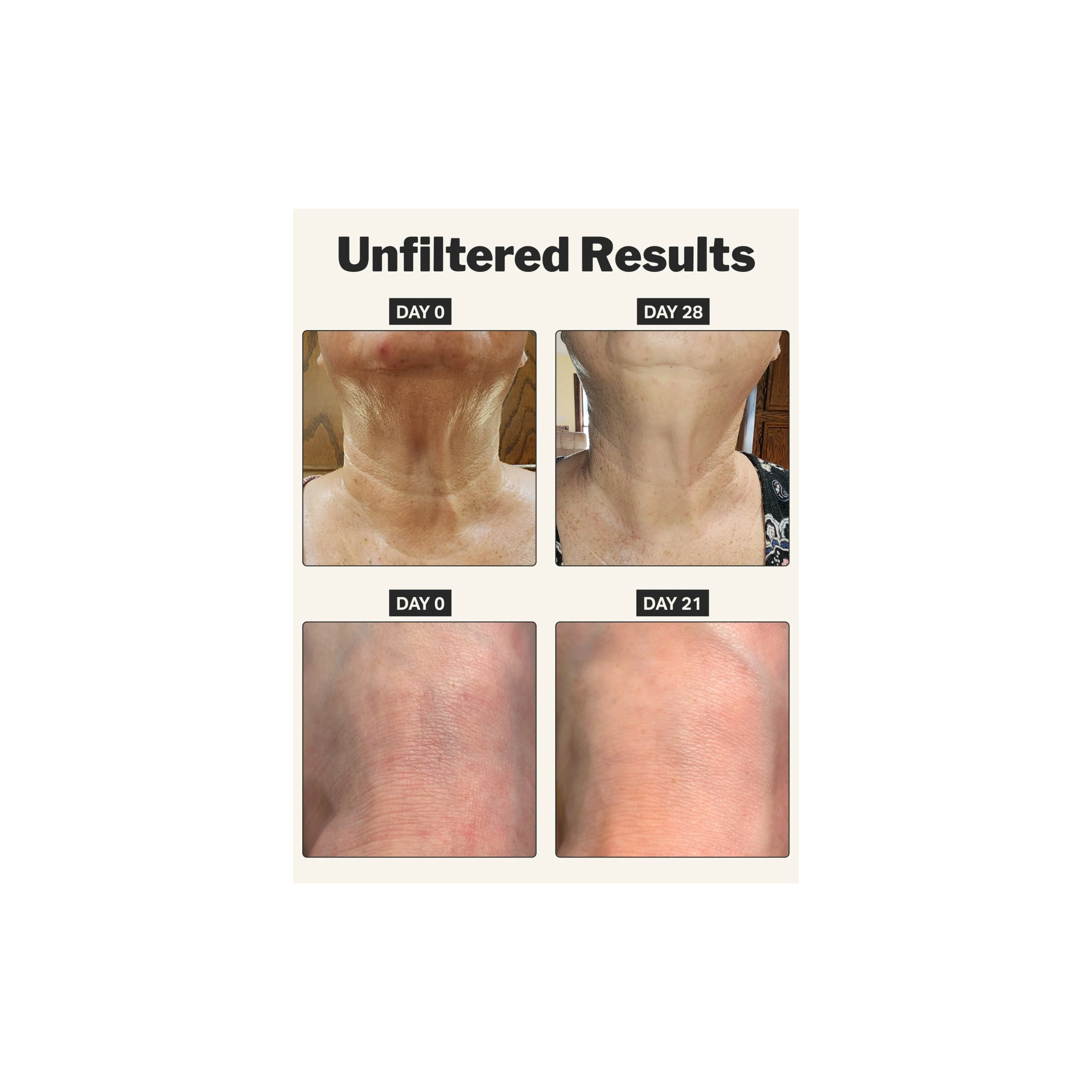 Retinol Body Cream