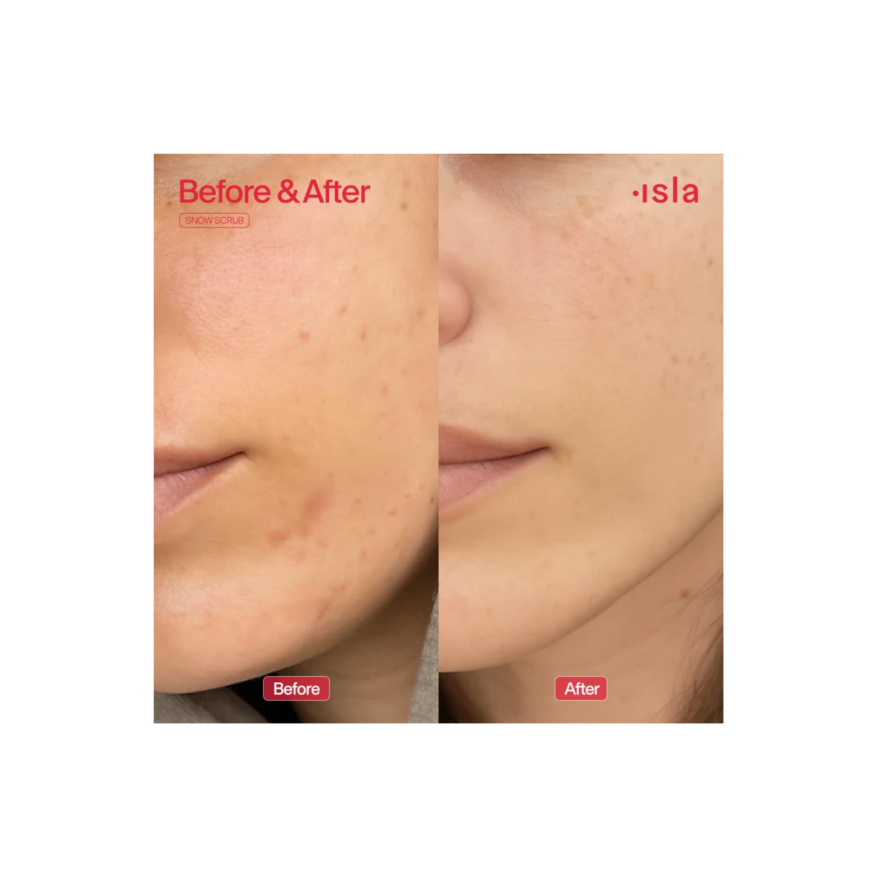 Snow Scrub Barrier Safe Exfoliant